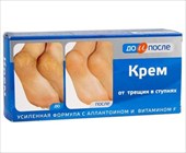 до и после крем от трещин в ступнях 50 мл фото
