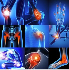 лечение опорно-двигательного аппарата