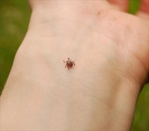 укус клеща: симптомы, диагностика, первая помощь и лечение.