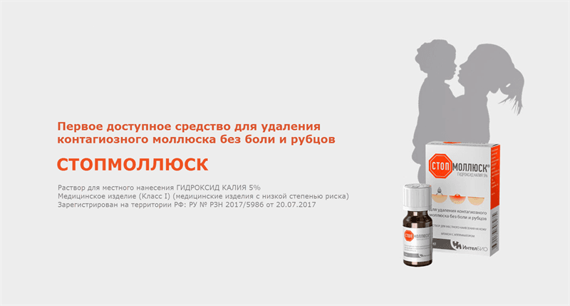 стопмоллюкс р-р для местн примен 5% 5мл для удал контагиозного моллюска